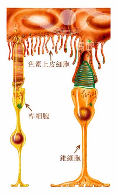 视网膜色素变性