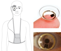 24小时眼压监控系统可以通过含芯片的隐形眼镜来连续量度病人眼压