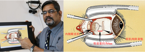 深圳希玛林顺朝眼科医院医生卡夫恩 深圳希玛林顺朝眼科医院医生卡夫恩