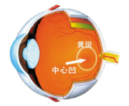 治疗黄斑变性要趁早--上海爱尔眼科医生董珺
