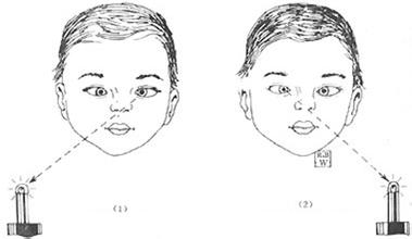 斜视眼看3D电影是什么感觉？