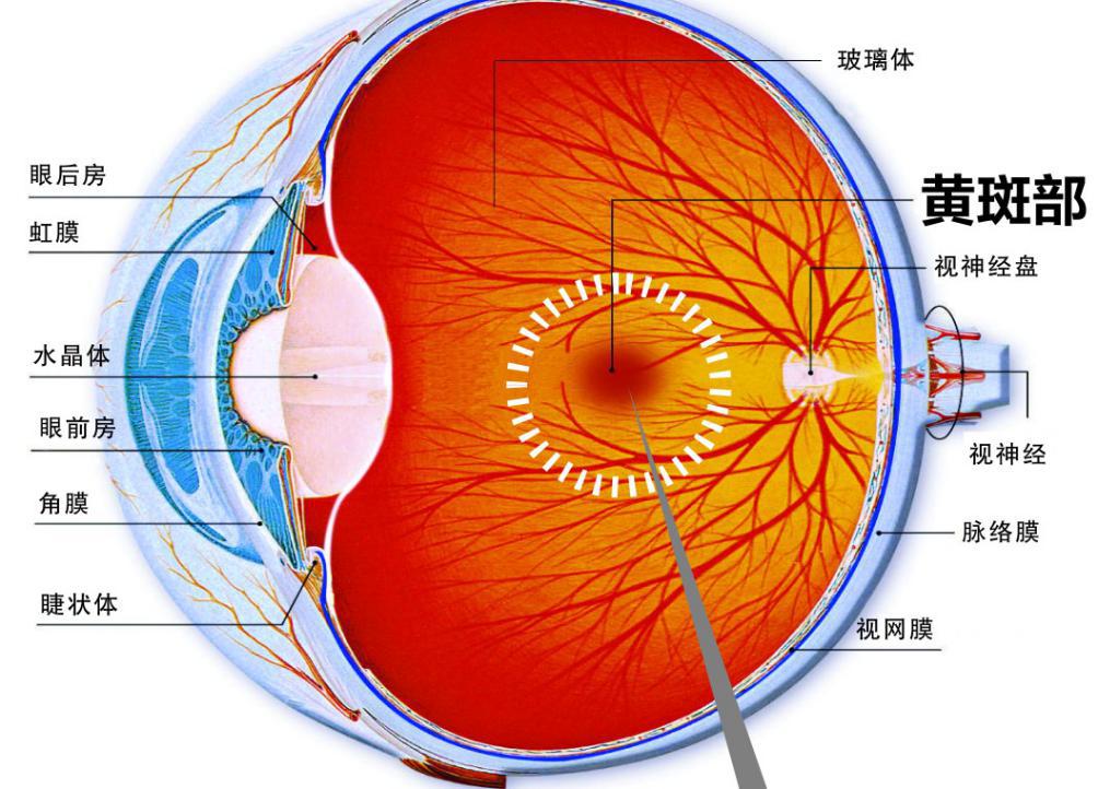 黄斑裂孔需尽早手术松解牵拉