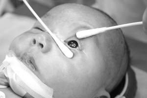 如何治疗儿童白内障?能治疗好吗